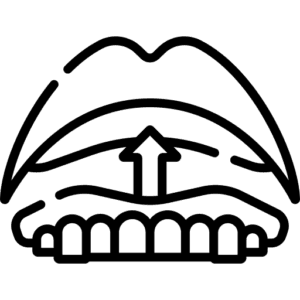 Prótese Overdenture